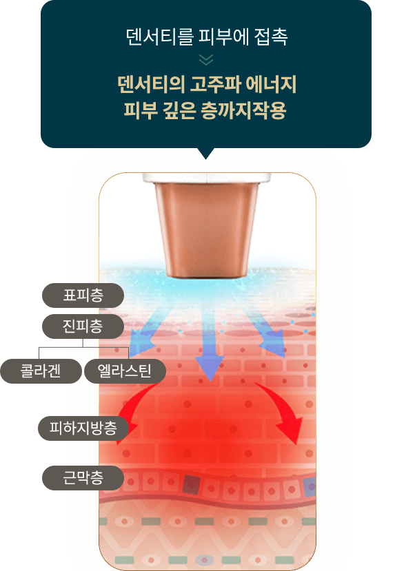 덴서티를 피부에 접촉하여 피부 깊은 층까지 작용